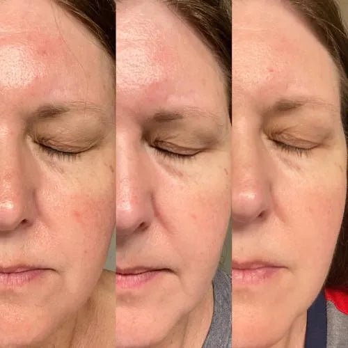 GlowMask LED Red Light Therapy Mask - REDVELLA